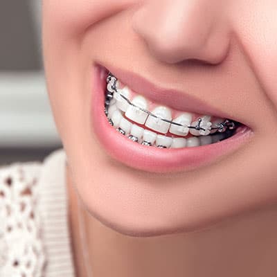 MDS - Orthodontics and Dentofacial Orthopaedics