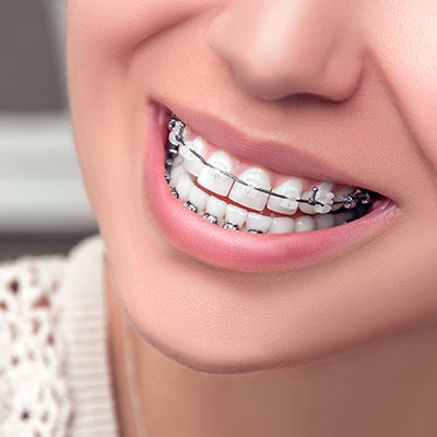 MDS - Orthodontics and Dentofacial Orthopaedics